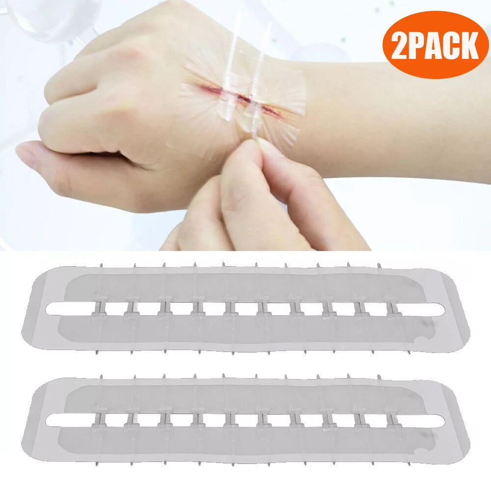 2X Wound Closure Strips for Emergency Protection Zip Stitch Sutures