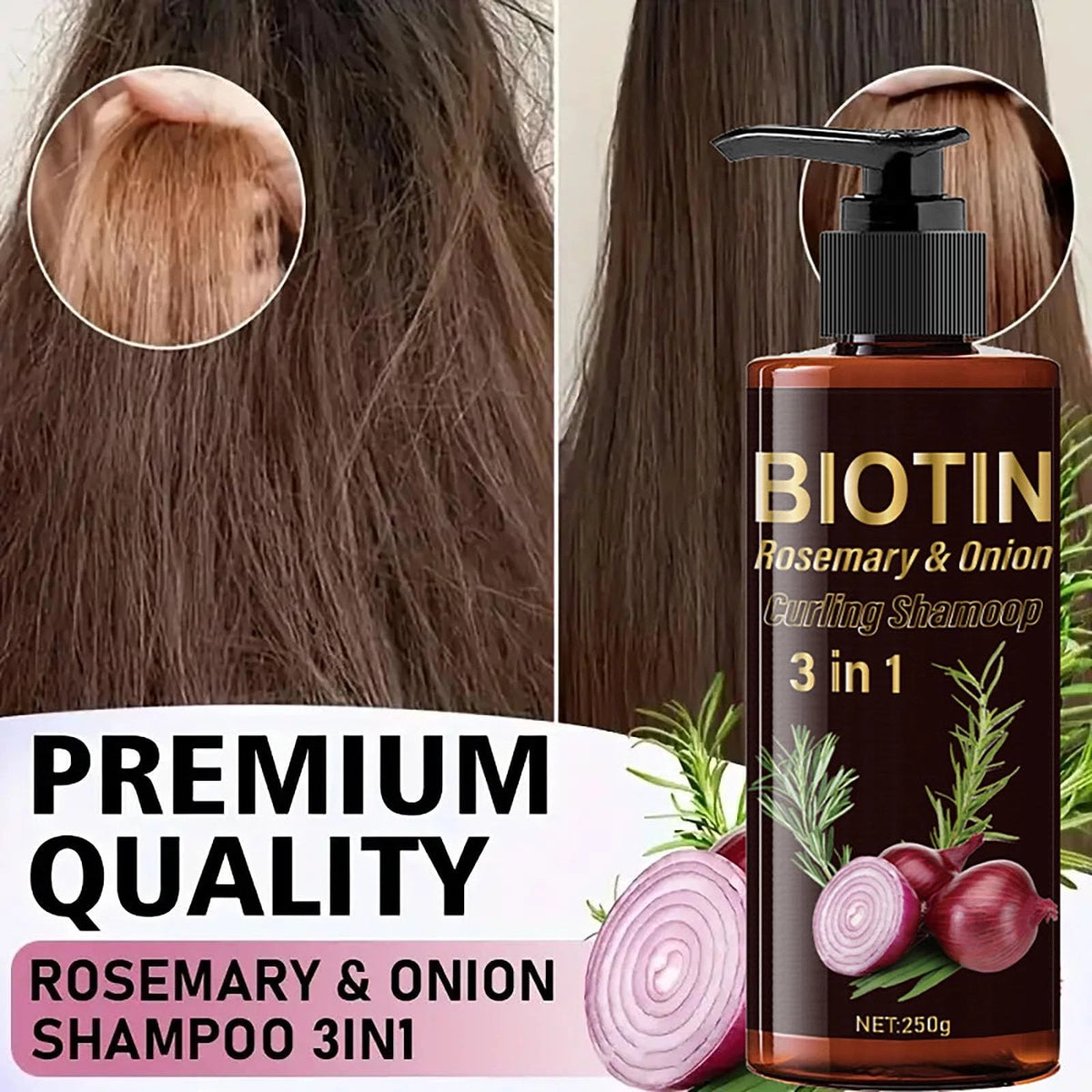 Onion Biotin Rosemary Shampoo for Hair Growth (Pack of 1)