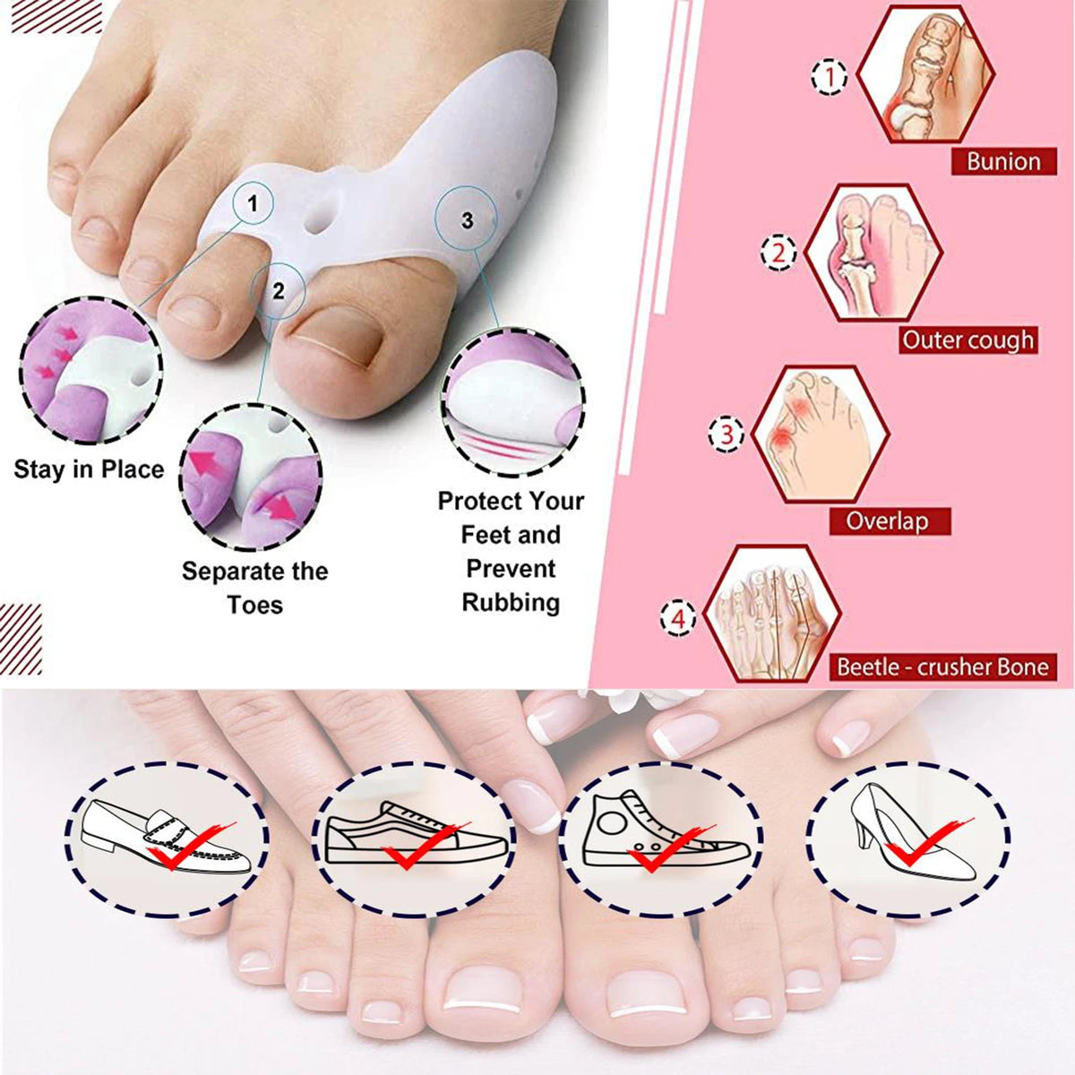 1 Pair Silicone Gel Bunion Toe Corrector for Orthotics Pain Relief
