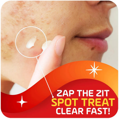 Asepxia 2% Salicylic Acid Acne Spot Treatment for Acne (Pack of 1)