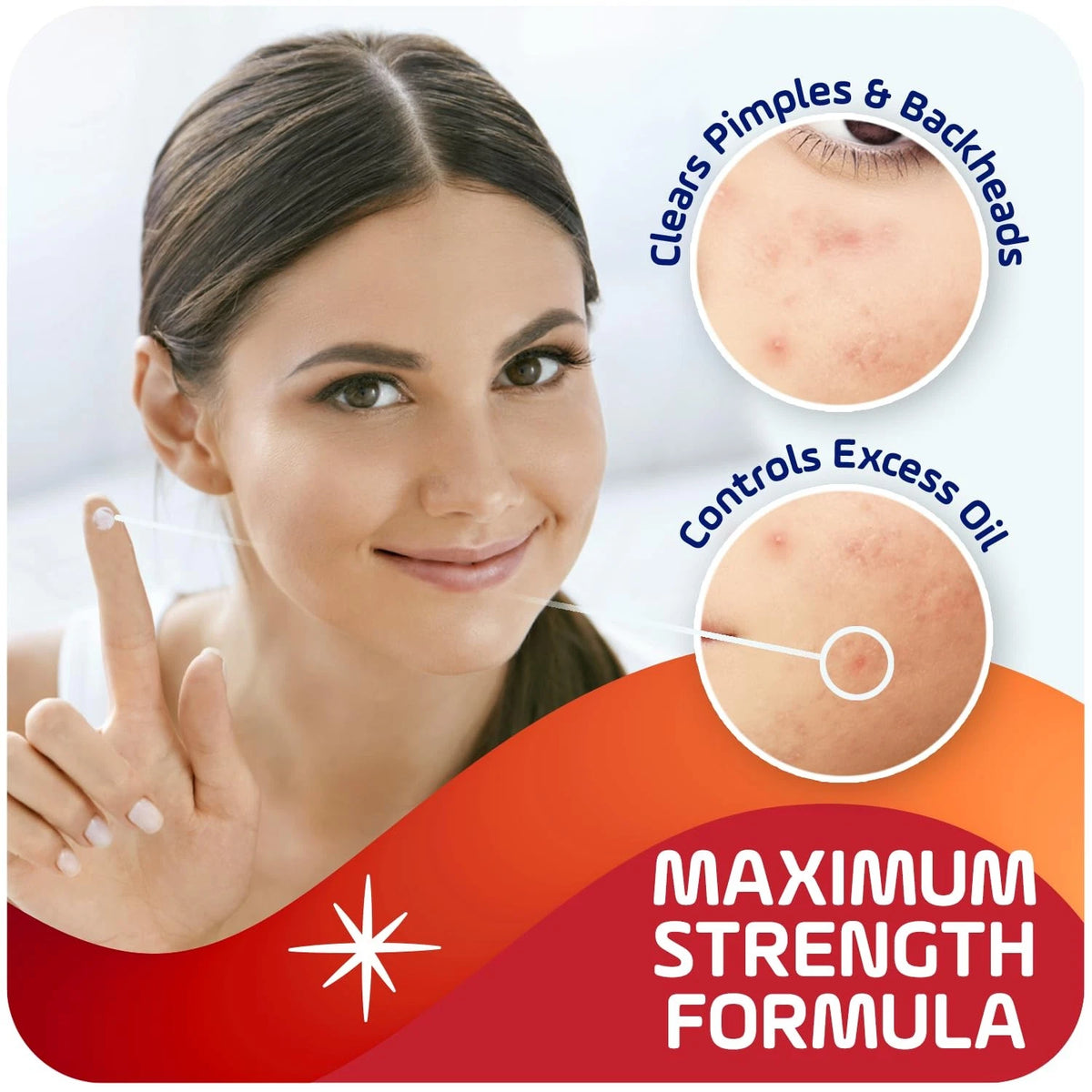Asepxia 2% Salicylic Acid Acne Spot Treatment for Acne (Pack of 1)