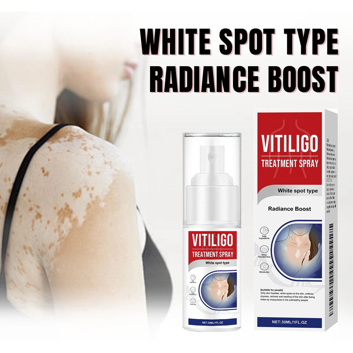 2X Vitiligo Treatment Spray for Natural Skin Care (1 fl oz)
