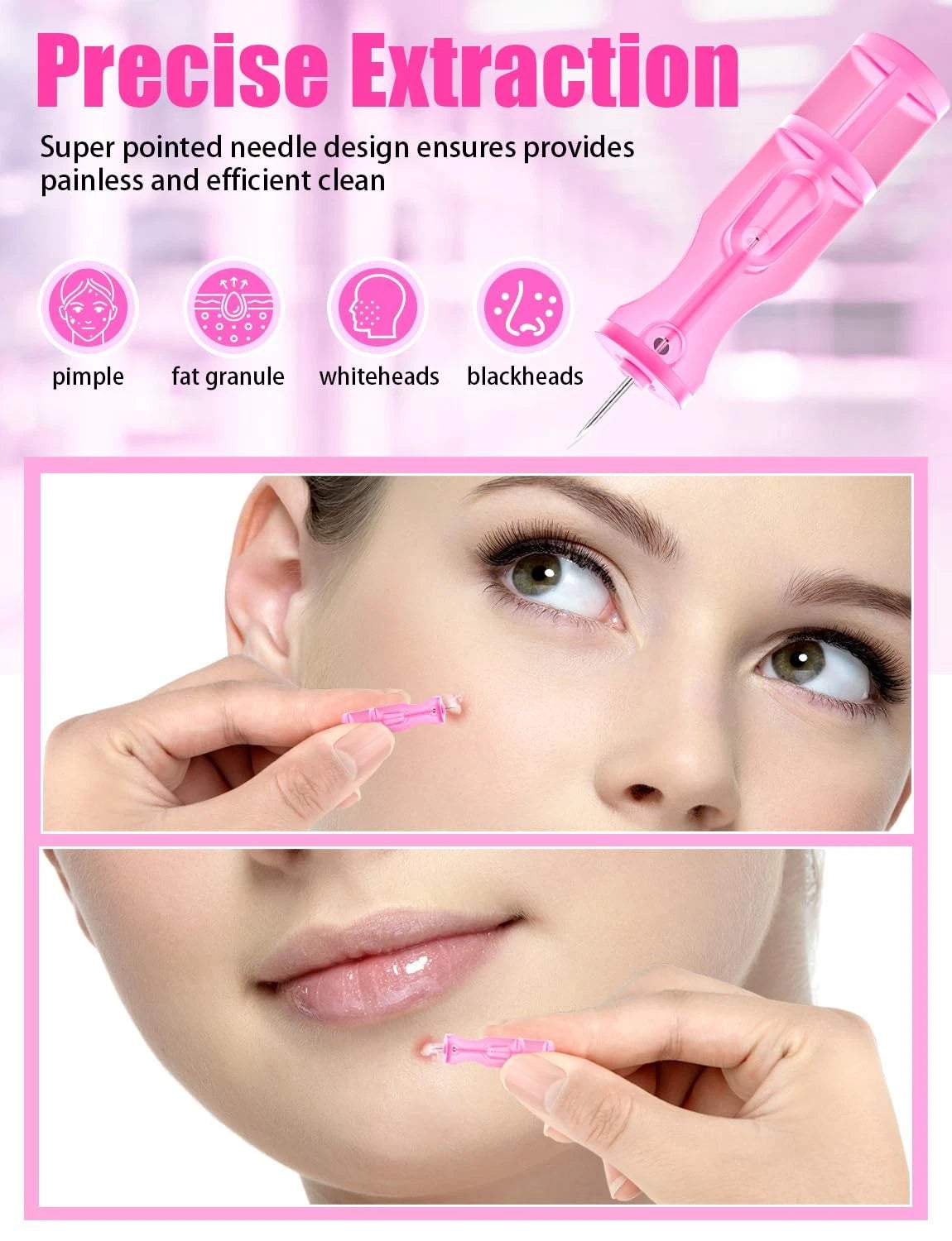 50 Pack Lancets for Facial Extraction