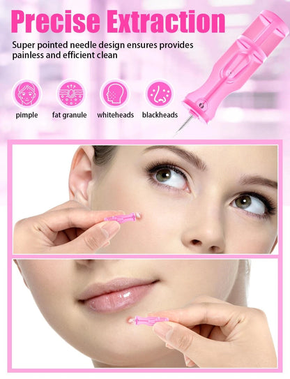 50 Pack Lancets for Facial Extraction