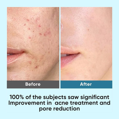 Exfoliating Glycolic Acid Facial Pads for Women