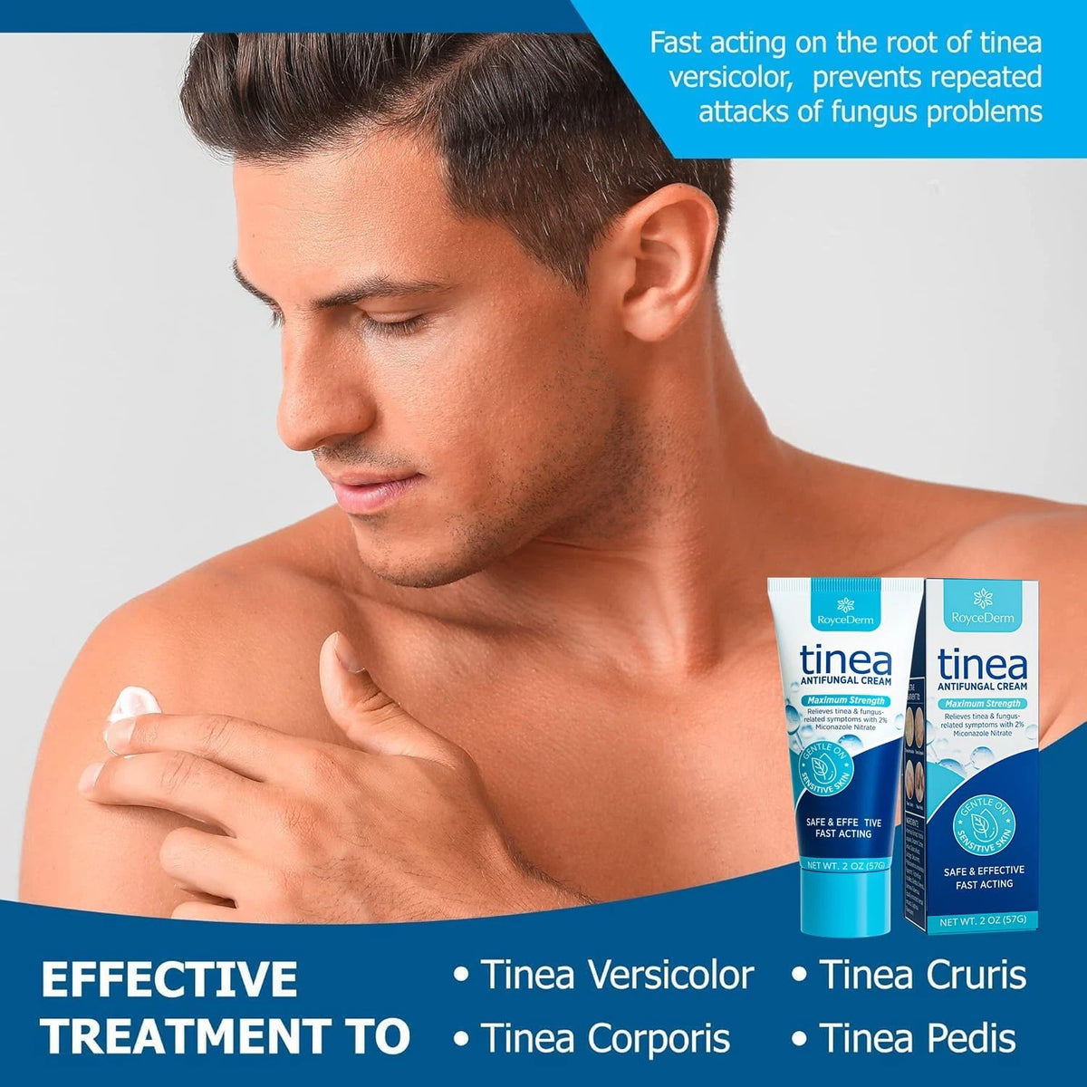 Tinea Versicolor Treatment for Athletes Foot (2 Ounce)