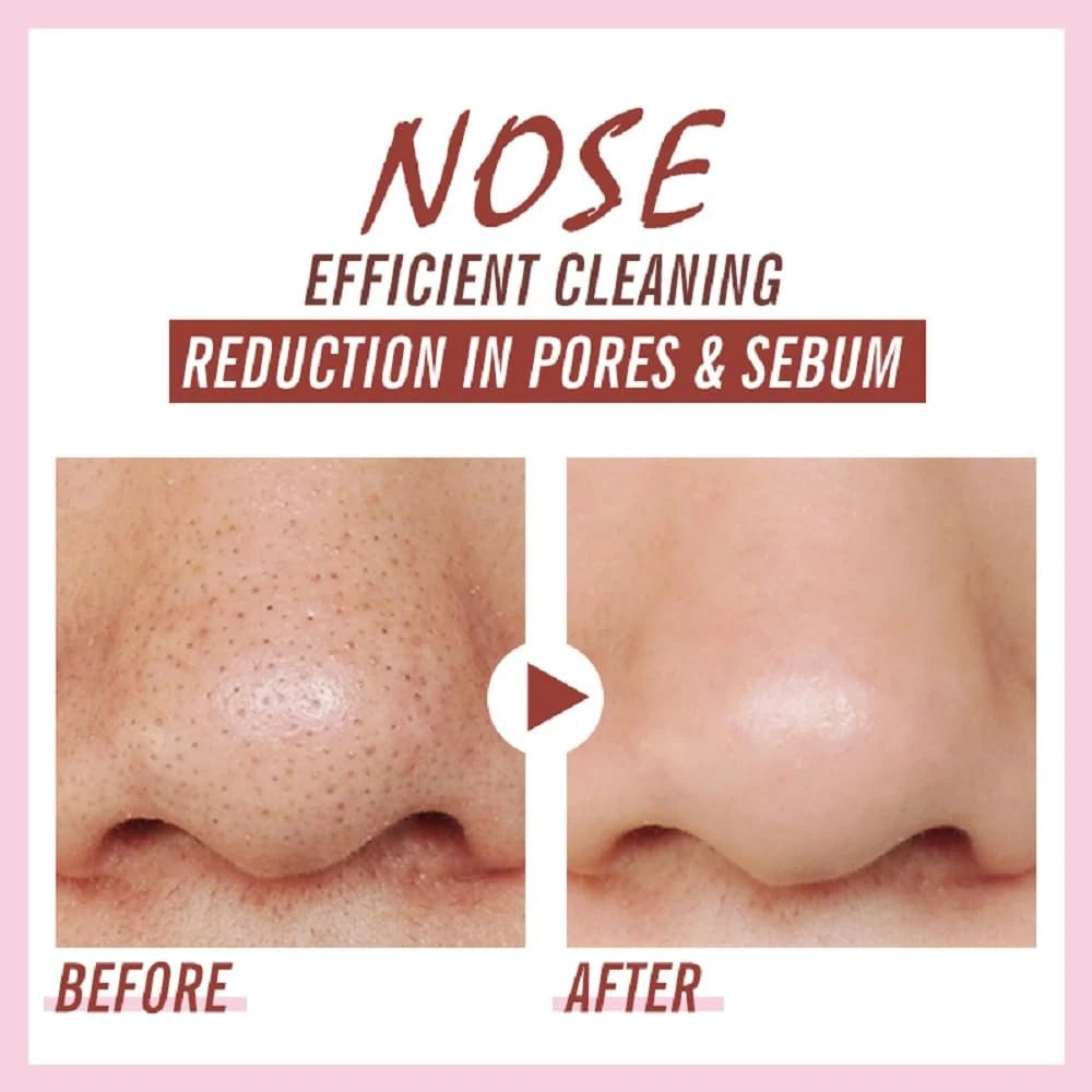Blackhead Remover Nose Pore Strips for Deep Cleansing