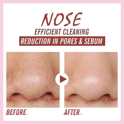 Blackhead Remover Nose Pore Strips for Deep Cleansing