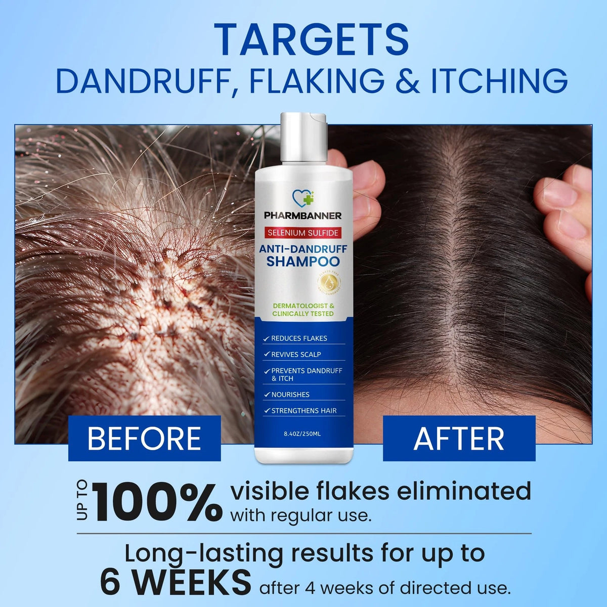 Anti-Dandruff Shampoo with Selenium for Hair Care (Pack of 1)