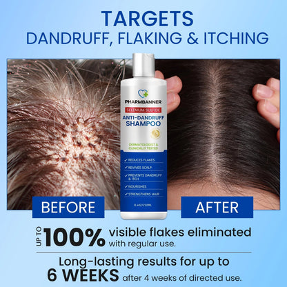 Anti-Dandruff Shampoo with Selenium for Hair Care (Pack of 1)