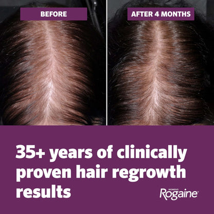 Rogaine Hair Growth Foam 5% for Women (Pack of 1)