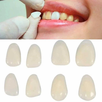 96pcs Dental Tooth Veneer Anterior Resin Thin Teeth Veneers