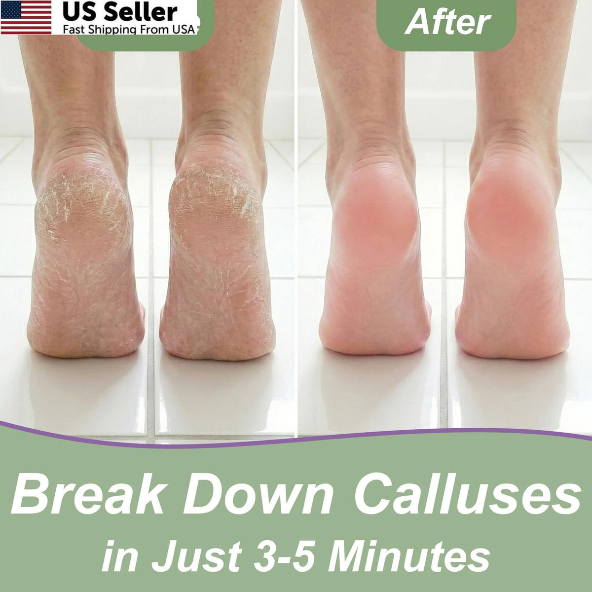 Callus Remover Gel & Foot File for Dr. Entre's (Pack of 1)