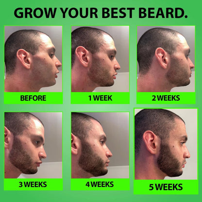 Minoxidil 5% Serum for Beard Growth (Pack of 1)