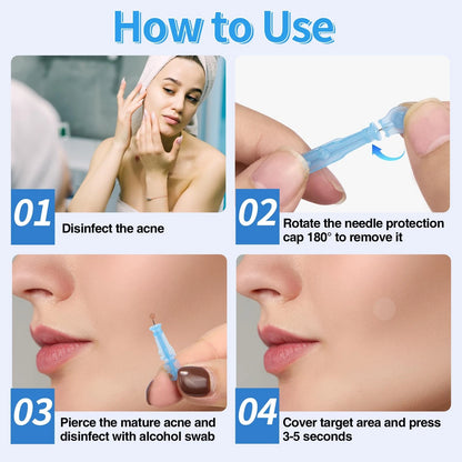 80 pcs Pimple Needle Kit for Skin Care (0.3mm)