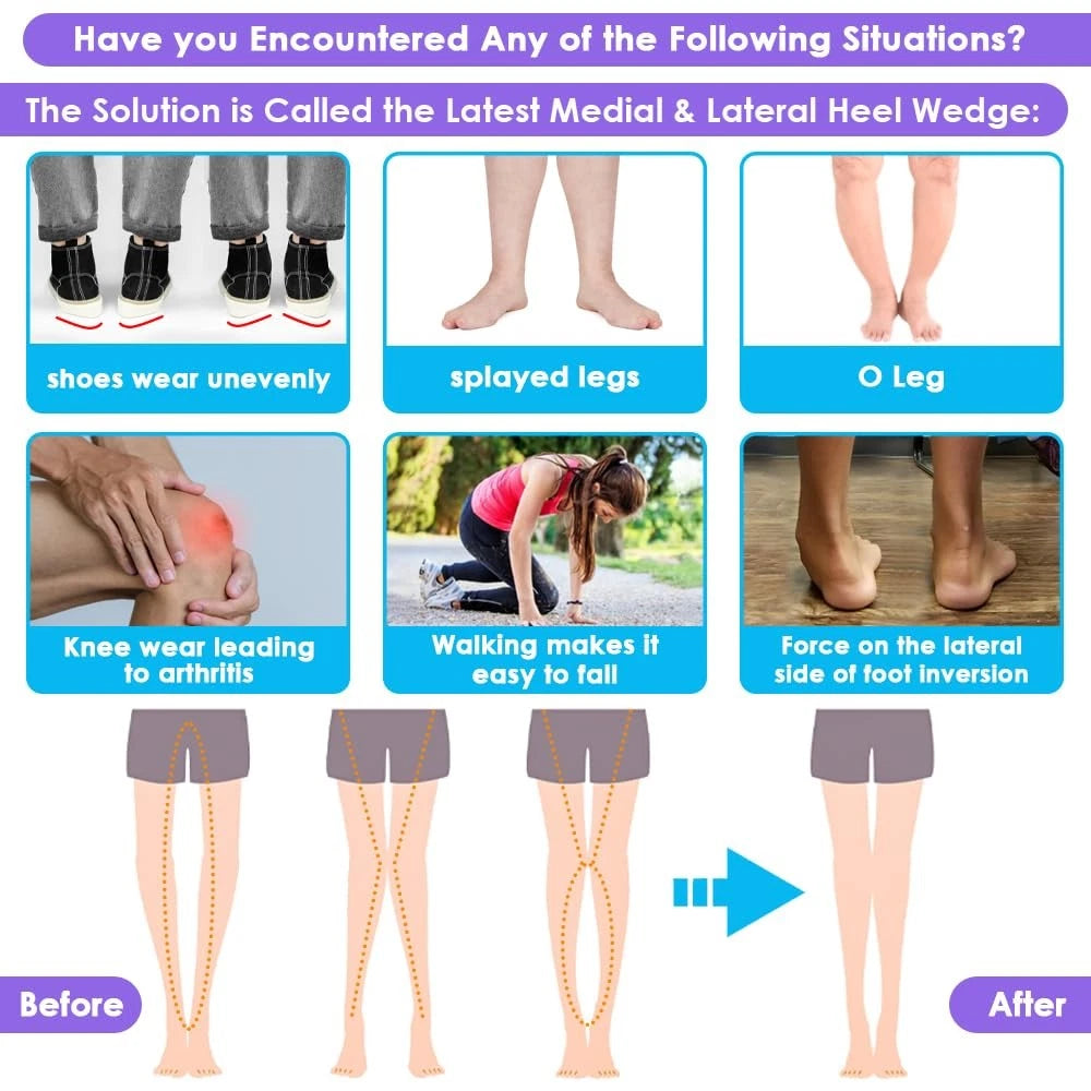 3 Layers Adjustable Supination Insoles for Various Sizes (L: 8-12, M: 7.5-14)