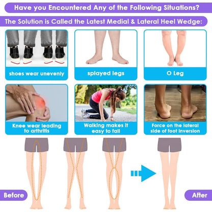3 Layers Adjustable Supination Insoles for Various Sizes (L: 8-12, M: 7.5-14)