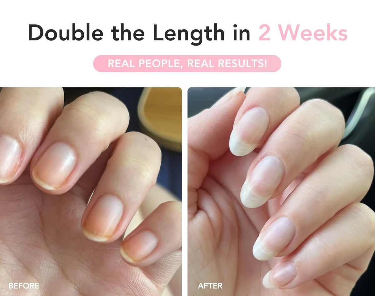 Nail Serum for Growth and Strength (Pack of 1)