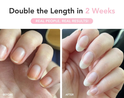 Nail Serum for Growth and Strength (Pack of 1)