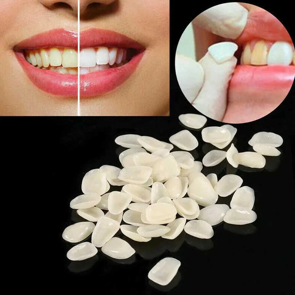 96pcs Dental Tooth Veneer Anterior Resin Thin Teeth Veneers