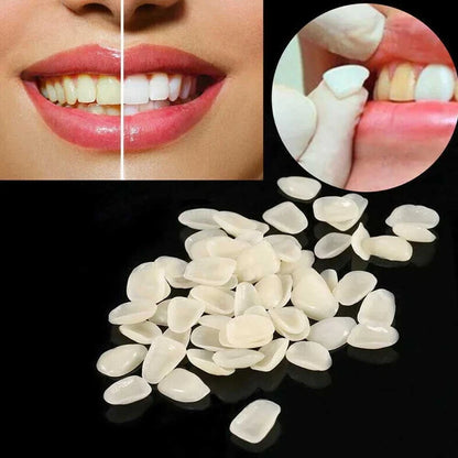 96pcs Dental Tooth Veneer Anterior Resin Thin Teeth Veneers
