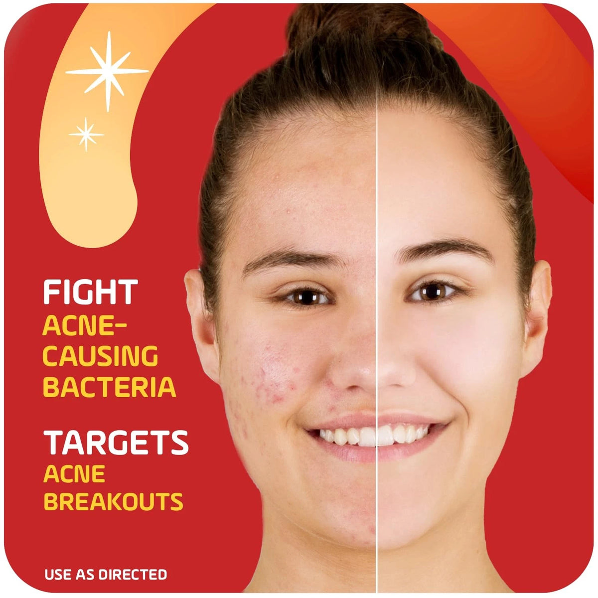 Asepxia 2% Salicylic Acid Acne Spot Treatment for Acne (Pack of 1)