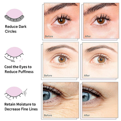 30 Pairs of 24K Gold Under Eye Patches for Collagen Treatment