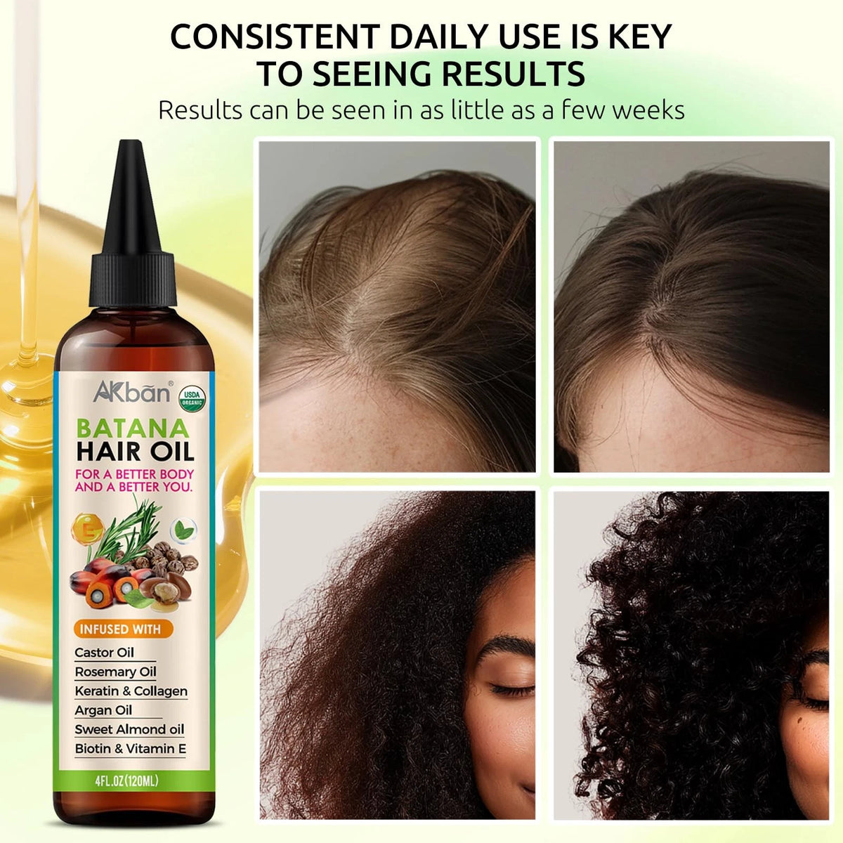 Hair Growth Oil for All Hair Types (4 Fl Oz)